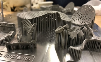 Titanium 3D printing technology is widely used in Surgical implants field